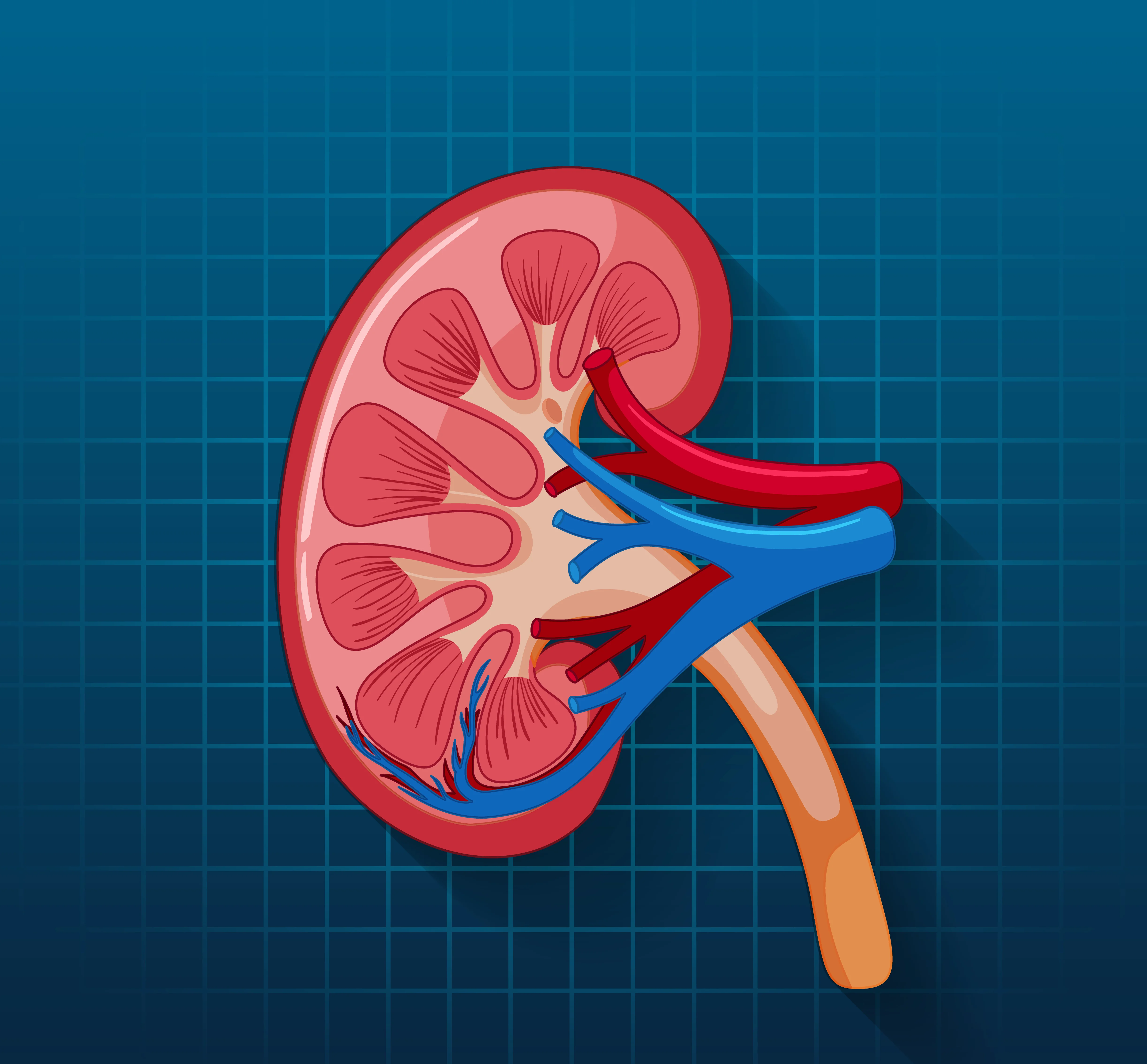 Acute Kidney Injury AKI