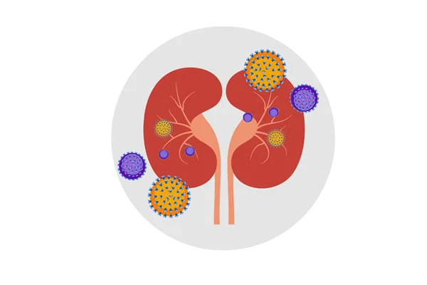 PostTransplant Infections